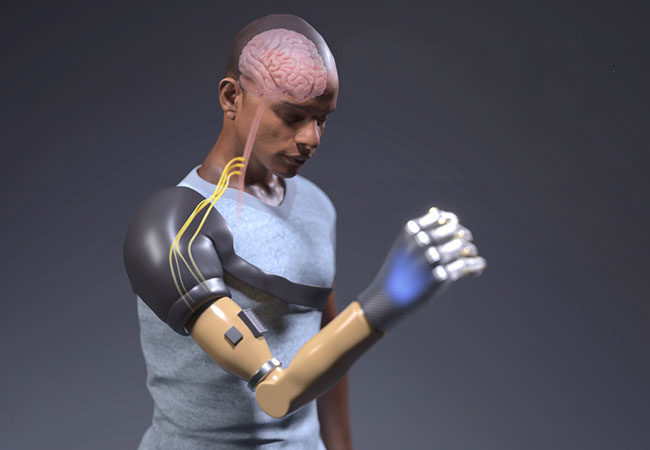 Wearing a Deus Ex-inspired bionic arm is the future of prosthetics - CNET